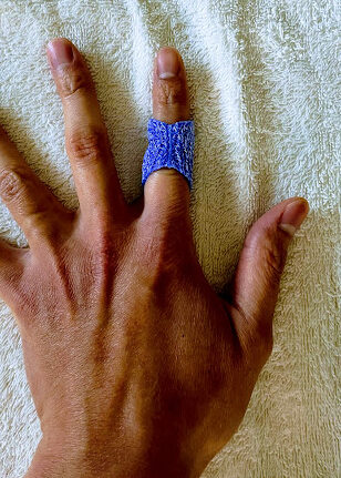 手のスプリント（装具） | 肩肘手指専門施術院